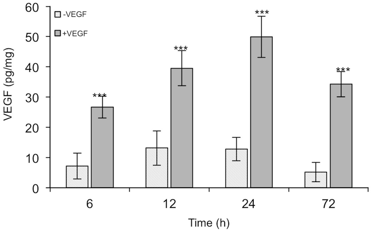 Reproducible Results with VEGF DuoSet ELISA from R&D Systems Kit/Reagent Review